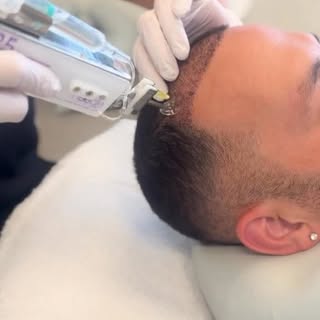 Een haartransplantatie is meer dan alleen de behandeling zelf. 💫

Wanneer je bij ons een haartransp