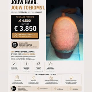 ☀️ Zomeractie Haartransplantatie in Zeeland ☀️

Droom jij van een vollere haardos? Dan is dit hét mo