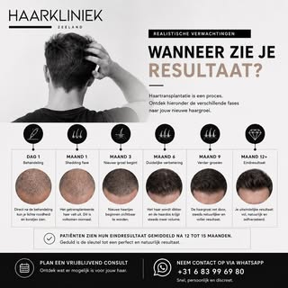 Wanneer zie je resultaat na een haartransplantatie? 🤔

Een haartransplantatie is een proces waarbij