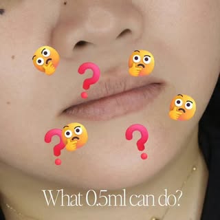 What 0.5ml can do? 💉👄

Book Your Appointments:
Call or WhatsApp
📞📱 +97143450045

💸 Installment 