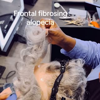 “Creating seamless results for clients with Frontal Fibrosing Alopecia is never ‘just hair’ — it’s t