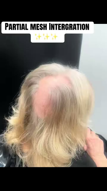 Because sometimes, it’s not just about the hair… it’s about how having your hair back makes you feel