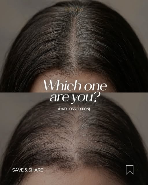 Which one are you ? A or B? 👀

When it comes to hair health, do you wait and react ,or understand w