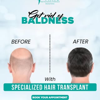 ✨ 𝐒𝐚𝐲 𝐆𝐨𝐨𝐝𝐛𝐲𝐞 𝐭𝐨 𝐁𝐚𝐥𝐝𝐧𝐞𝐬𝐬 𝐑𝐞𝐬𝐭𝐨𝐫𝐞 𝐘𝐨𝐮𝐫 𝐂𝐨𝐧𝐟𝐢𝐝𝐞𝐧𝐜𝐞! ✨

Tired
