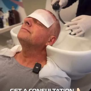 HAIR TRANSPLANT IN TURKEY 🇹🇷

We provide:
👉🏻VIP service
👉🏻Maximum quality of the hair  transpl