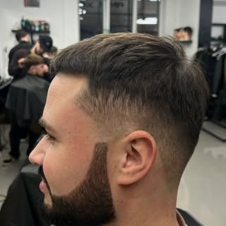 HAIR TRANSPLANT
6 months after the hair transplant (final result at 12 months)
Visit our website: ha