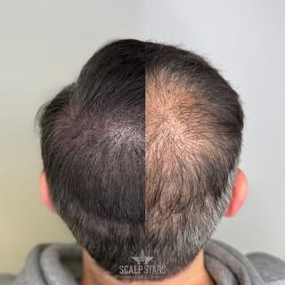 Nein, das ist kein Fake und keine Bearbeitung!Swipe👉🏻 für das vorher/nachher Foto.Unser Kunde hatt