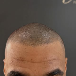 Shaved Look. Klare Linie. Maximale Präsenz.

Mit präzise gesetzten Mikro-Pigmenten erzeugen wir die 