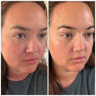Visibly brighter, hydrated, and plumper skin thanks to Skinbetter’s new Ampra Volumizing Macro HA Se