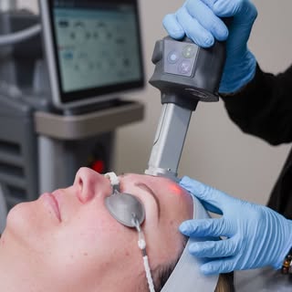 Trying to decide whether CoolPeel or Helix Fusion CO₂ is right for you?⁠
⁠
 ✨ CoolPeel is a great op