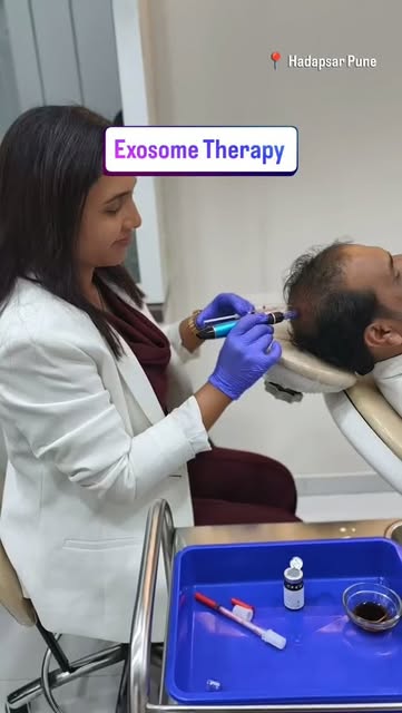 “Want fewer needle pricks for your hair treatment?”

PRP & GFC involve multiple scalp injections.

F