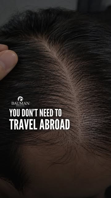Traveling abroad for a hair transplant may seem appealing, especially when price is the biggest sell