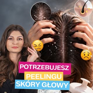 Jak rozpoznać, że skóra głowy potrzebuje peelingu?
Swędzi Cię skóra głowy, włosy szybko się przetłus