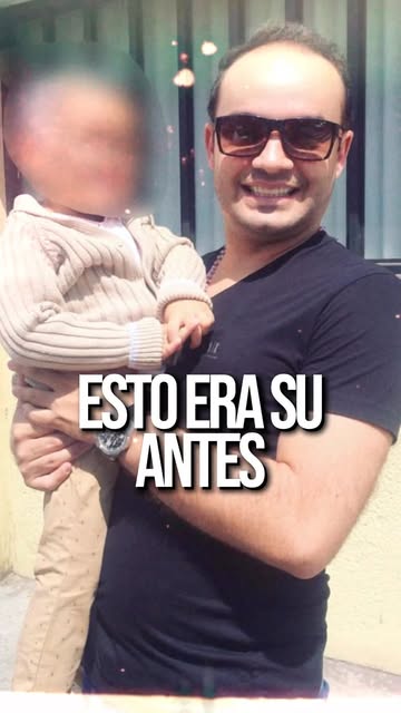 Hoy está lleno de confianza. Pero no siempre fue así.

Un implante capilar DHI puede cambiar mucho m