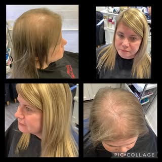 Yes this is the same person 🤩....Amazing transformation of an integrated hair system for this lovel