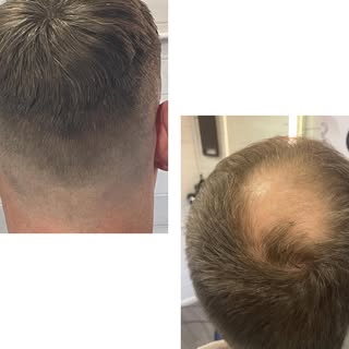 Mens hair systems and training available #training#barbers#barbershopconnect#menshairsystems#menshai