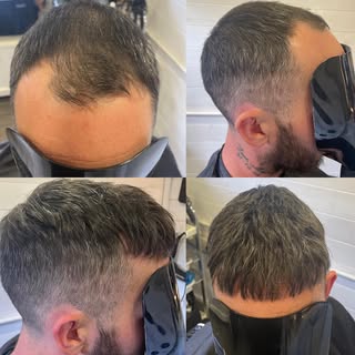 Revive Hair Clinic specialises in Men’s and Ladies Hair Systems with over 30 years experience in the