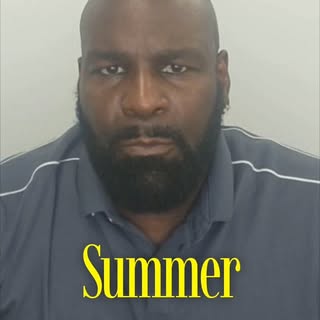 Summer, sweat, the pool — living fully with SMP
-
[hair loss, balding, SMP, Scalp Micropigmentation]