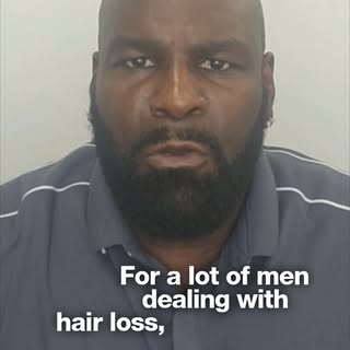 Walking into the next 4th of July party as yourself
-
[hair loss, balding, SMP, Scalp Micropigmentat