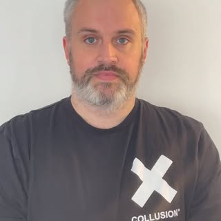 Meet Gavin, aged 41. He has been suffering from male pattern baldness for years, Gavin embraced his 