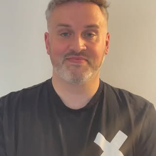 Meet Gavin, aged 41. He has been suffering from male pattern baldness for years, Gavin embraced his 
