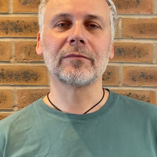 Meet Simon, aged 55. He has been suffering from male pattern baldness for a couple of years, Simon e