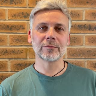 Meet Simon, aged 55. He has been suffering from male pattern baldness for a couple of years, Simon e
