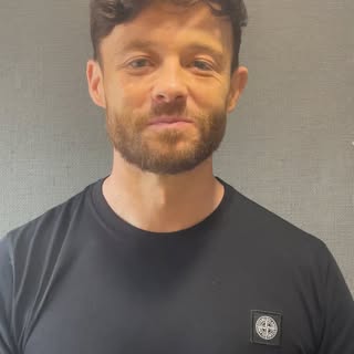 Meet Lloyd, aged 39. He has been suffering from male pattern baldness for some years. Lloyd had trie