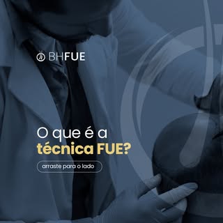 Você já conhece a técnica Fue? 

Através dela, temos devolvido a autoestima para milhares de homens 