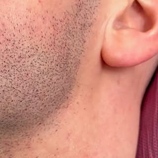 La Micropigmentation capillaire est indétectable! J’adore recréer des effets naturels 🤘🏼 #micropig