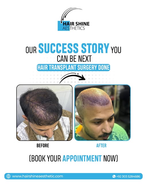 𝐘𝐨𝐮𝐫 𝐇𝐚𝐢𝐫 𝐓𝐫𝐚𝐧𝐬𝐟𝐨𝐫𝐦𝐚𝐭𝐢𝐨𝐧 𝐂𝐨𝐮𝐥𝐝 𝐁𝐞 𝐍𝐞𝐱𝐭!
At Hair Shine Aesthetics, w