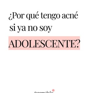 ¿Te sigue saliendo acné aunque ya no eres adolescente? 🤔 @dra_vanessa_martins 

El acné adulto exis