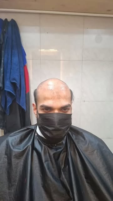 Golden hair fixing......
*Contact no.9867696977* 
Visit office no.21 A wing 2nd floor Jivarshri Apt 