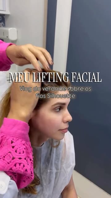 Meu lifting facial não-cirúrgico • Parte 1
