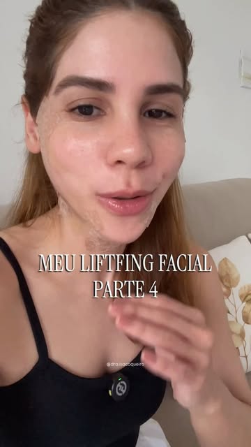 Meu lifting facial não-cirúrgico • Parte 4