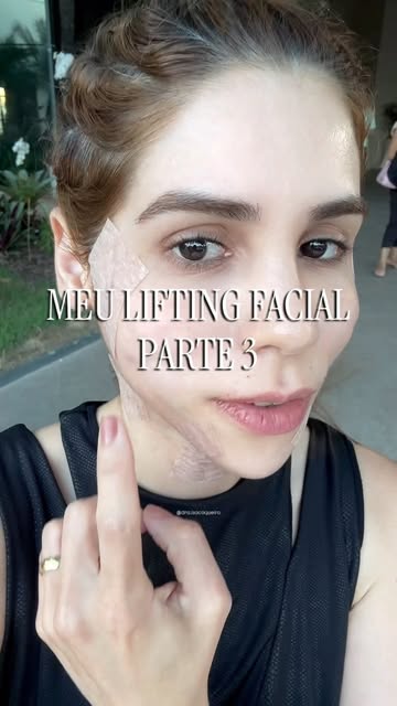 Meu lifting facial não-cirúrgico • Parte 3

Pós-imediato! Lábios pedindo socorro após a Clorexidina 
