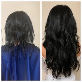 When your mood changes and your feeling Fun & Sexy! #hairtransplant #hairgrowth #hairrestoration #sc