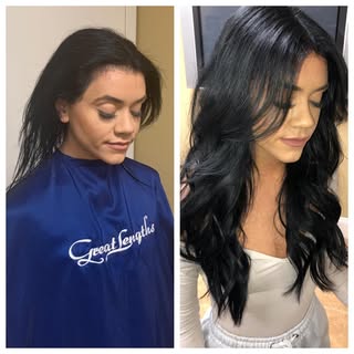 Wowww.. Stunning! #hairtransplant #hairgrowth #hairrestoration #scalpmicropigmentation #hairlosstrea
