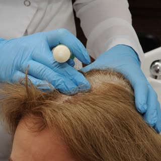 🌿 MENOPAUZA A WŁOSY 🌿

Twoje włosy się przerzedzają? Nie jesteś sama.

Po menopauzie wiele kobiet 