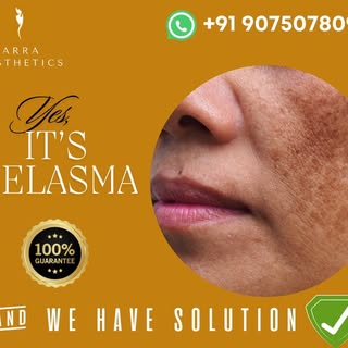 🌟 Our customized #melasma treatments help reduce #darkpatches, giving you the flawless skin you des