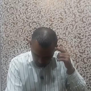 प्रत्येक केसामागे एक कथा असते—आमच्या पेशंटच्या केस ट्रान्सप्लांट अनुभवाची झलक!
हा अनुभव फक्त एका यशस