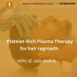 Dr. Vasant Gholave Talks About PRP Therapy for Hair Regrowth.
Discover how PRP (Platelet-Rich Plasma