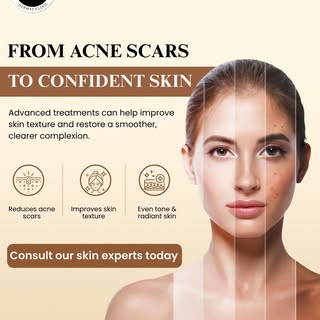 ✨ Say Goodbye to Acne Scars, Hello to Smooth & Confident Skin! ✨

Acne may be gone, but the scars do