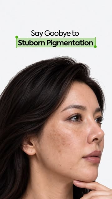 How to Treat Melasma? 
Dr. Sidra explains effective ways to manage melasma and achieve more even-loo
