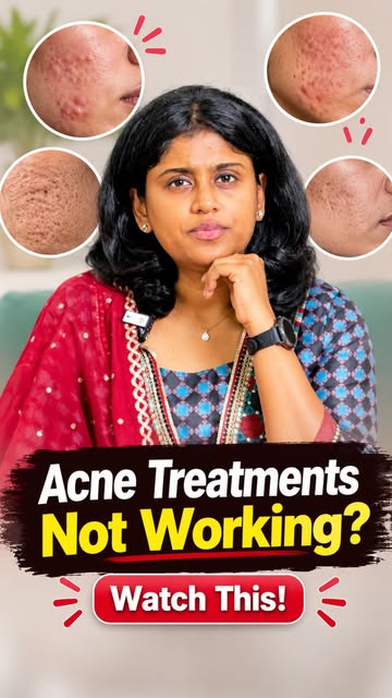Tried creams, peels, lasers… but those deep acne scars still haven’t gone away? 👀

There’s a reason