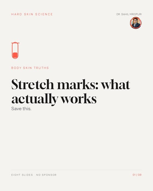 Stretch marks: what actually works.

They are tears in the deeper skin from rapid stretch, so they s