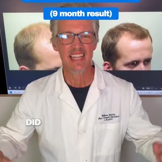 Did this guy grow hair? You tell me in the comments.

This patient came to me and after nine months 