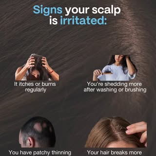 Your scalp is skin, and like skin anywhere else on your body, it responds to stress.

These signs do