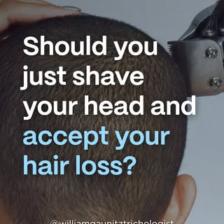 Choosing to shave your head is a valid decision. But there's a difference between choosing it becaus