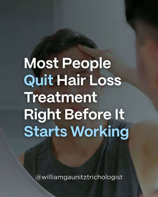 Most people quit hair loss treatment during the phase where results are happening but not yet visibl